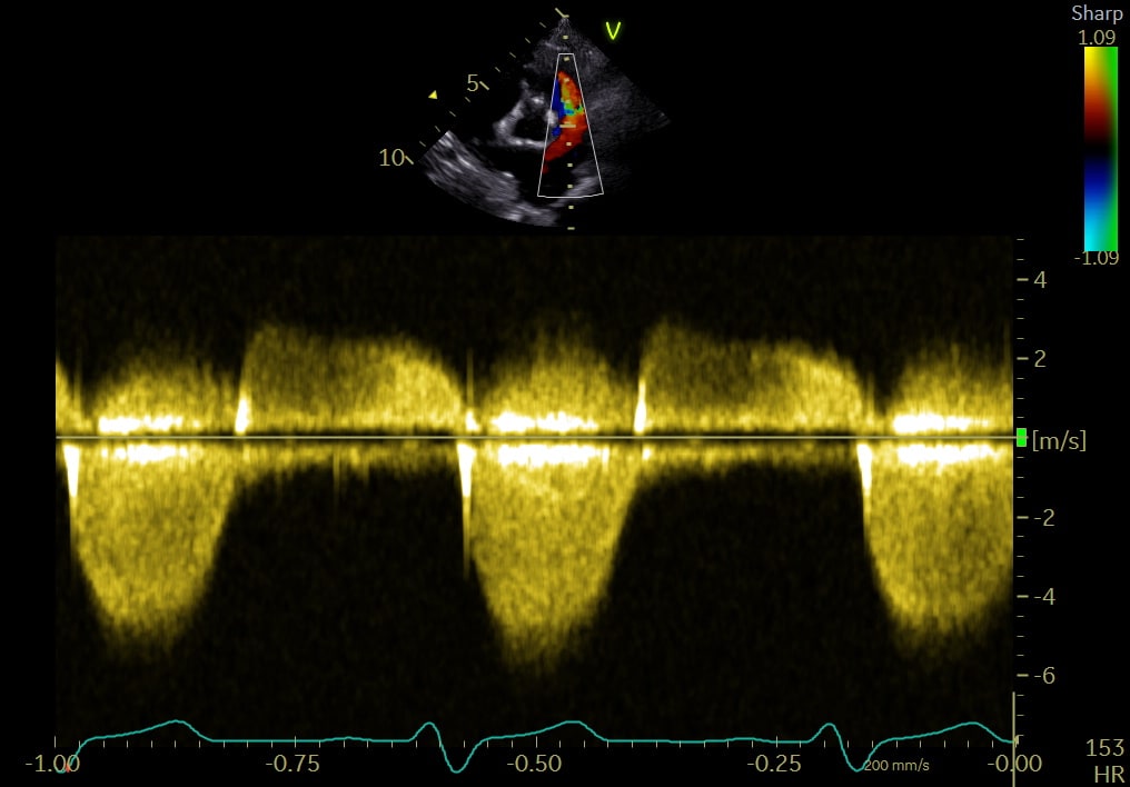 Cat undergoing an echocardiographic examination