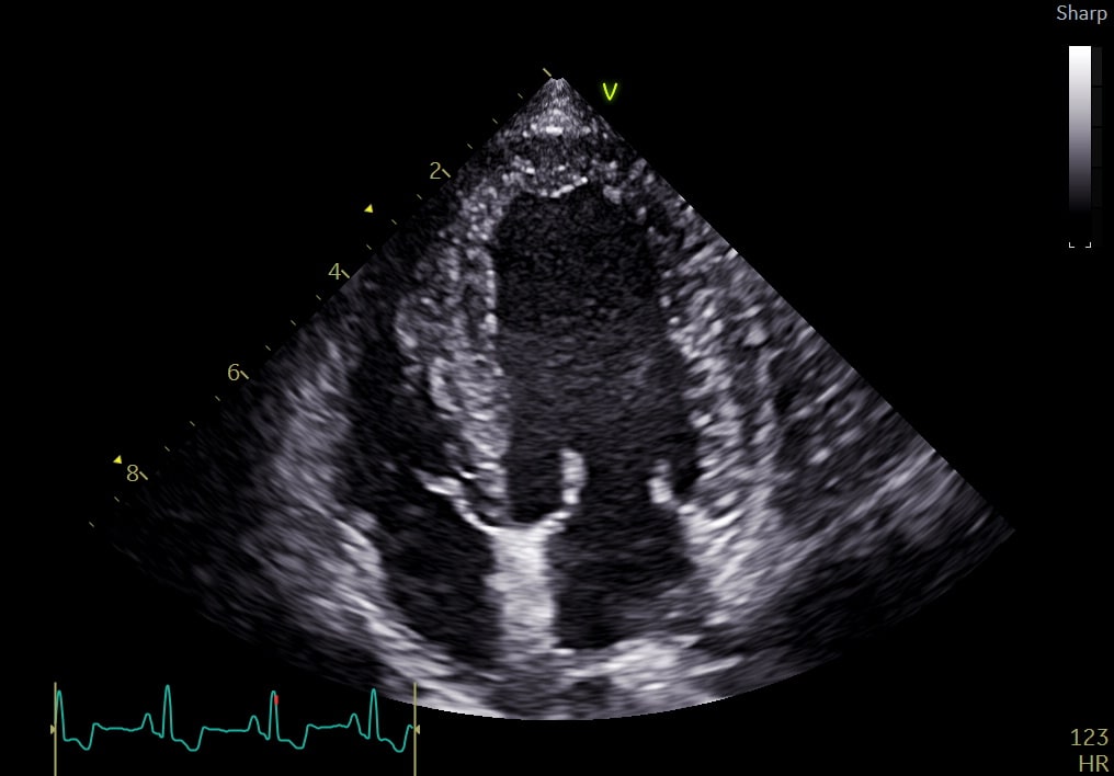 Cat undergoing an echocardiographic examination