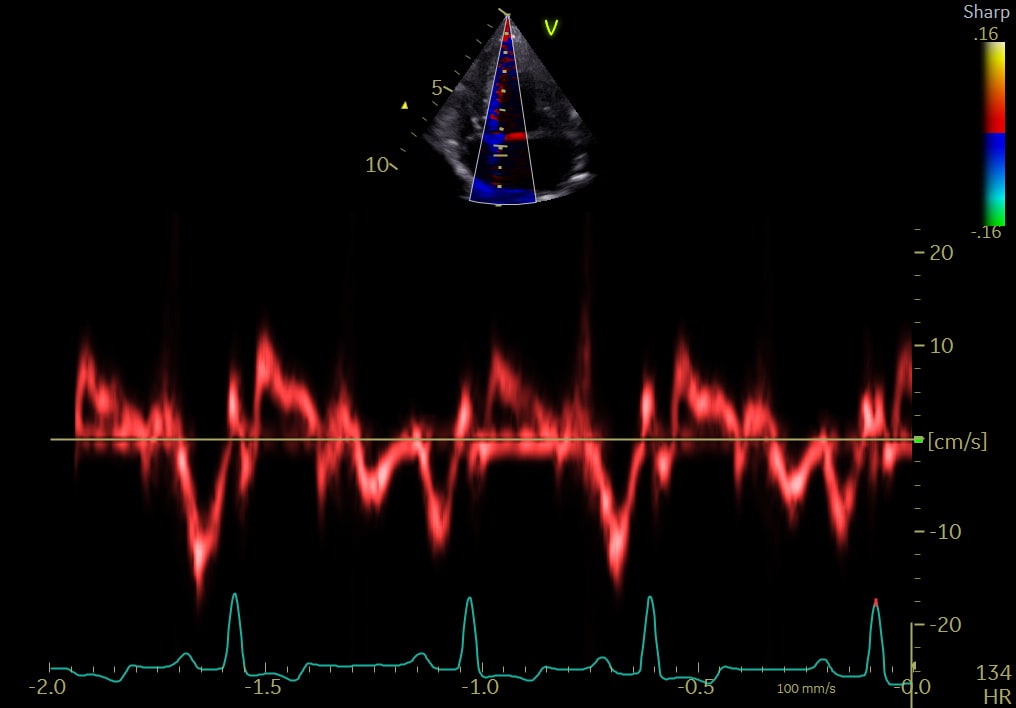 Cat undergoing an echocardiographic examination