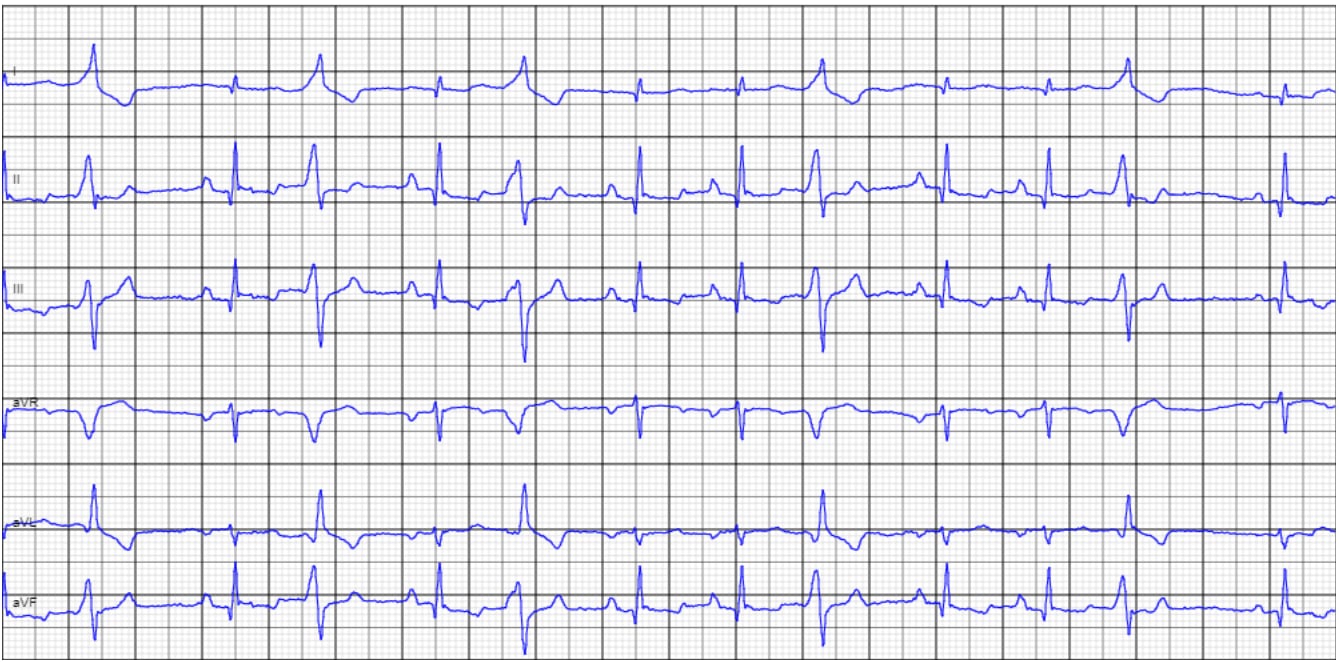 Cardiologist reviewing a complete cardiology case