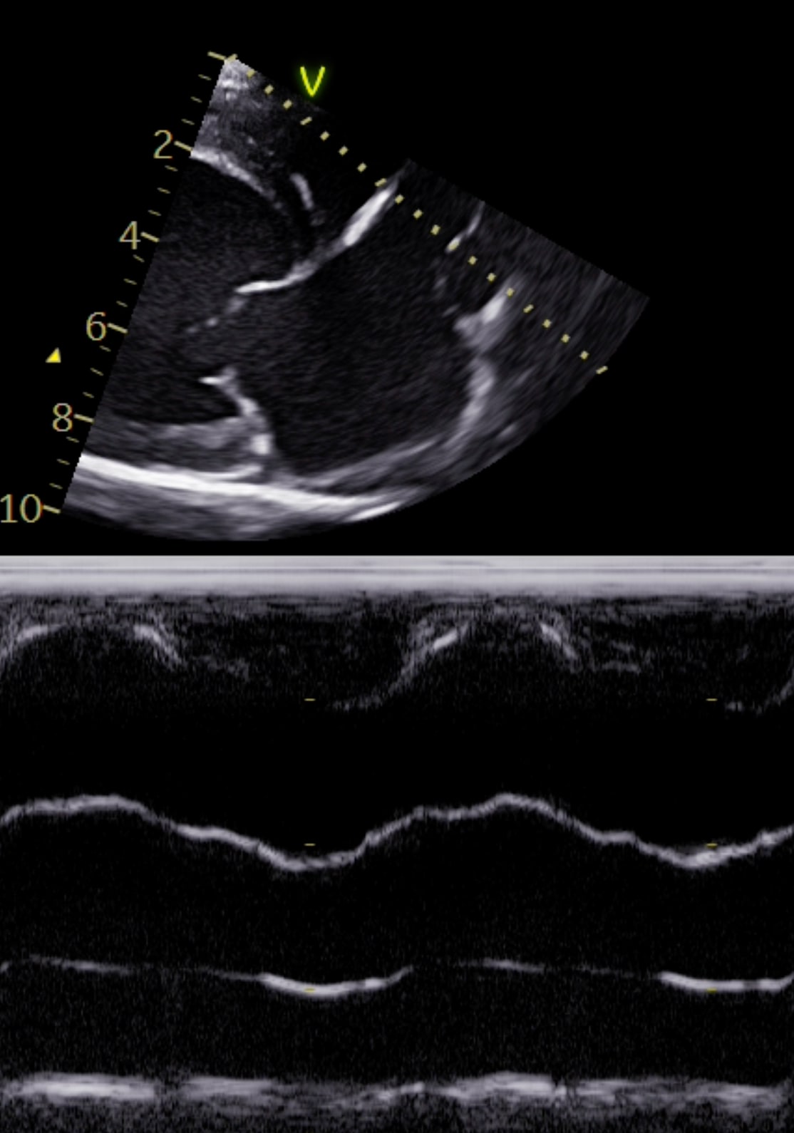 Cardiologist reviewing a complete cardiology case