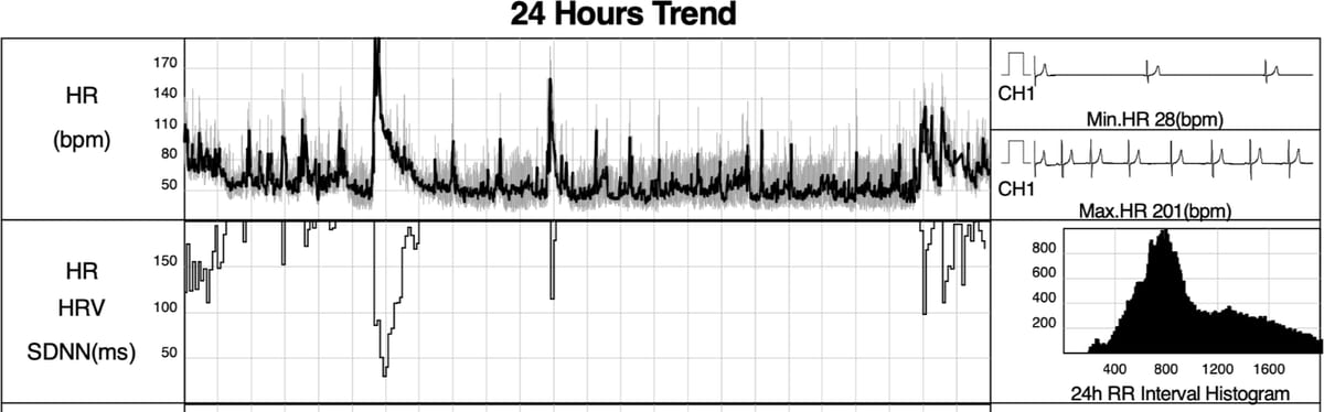 24-hour heart rate trend from a Holter recording