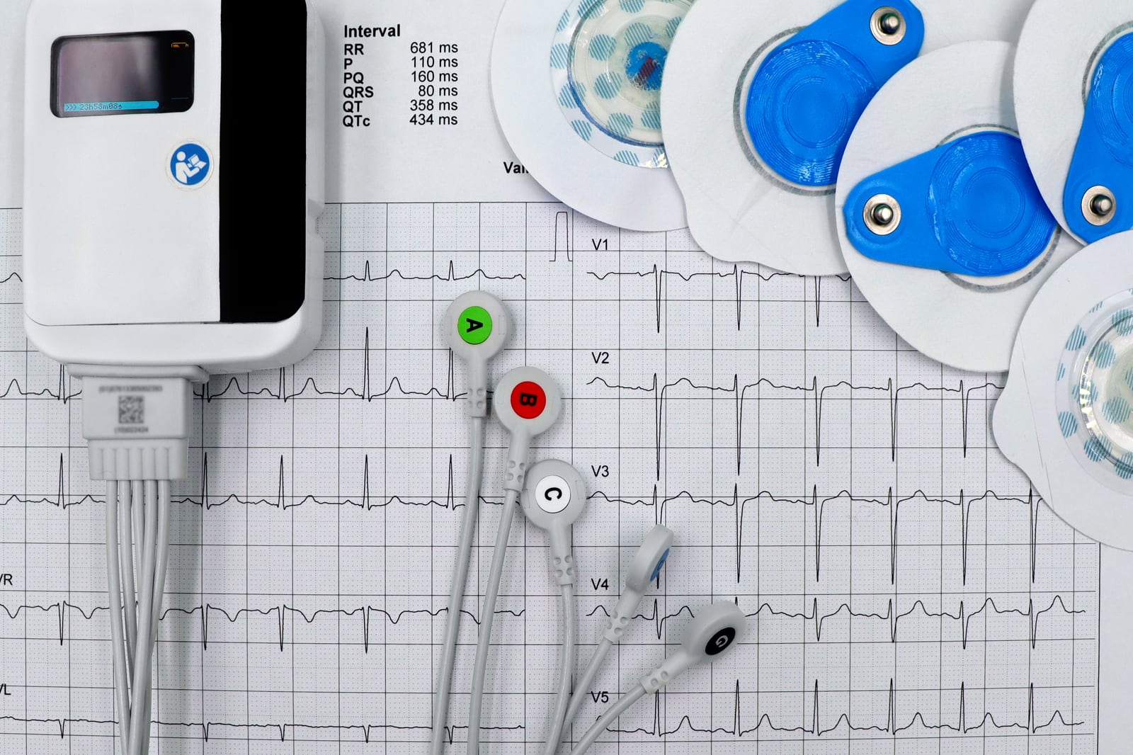 Holter recorder, electrodes and an ECG trace